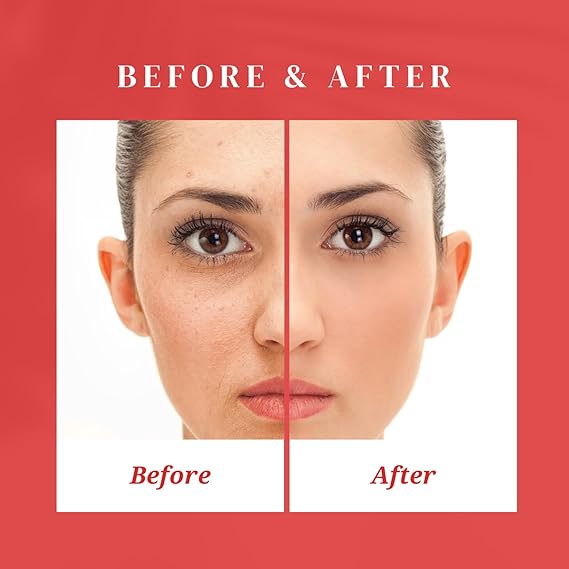 EVENTONE-C® Glutathione + Vitamin C Intensive Skin Fairness Cream